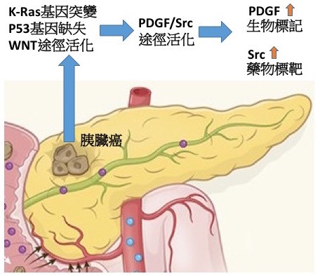 Genetic interplay greatly influences drug response of pancreatic cancer patients