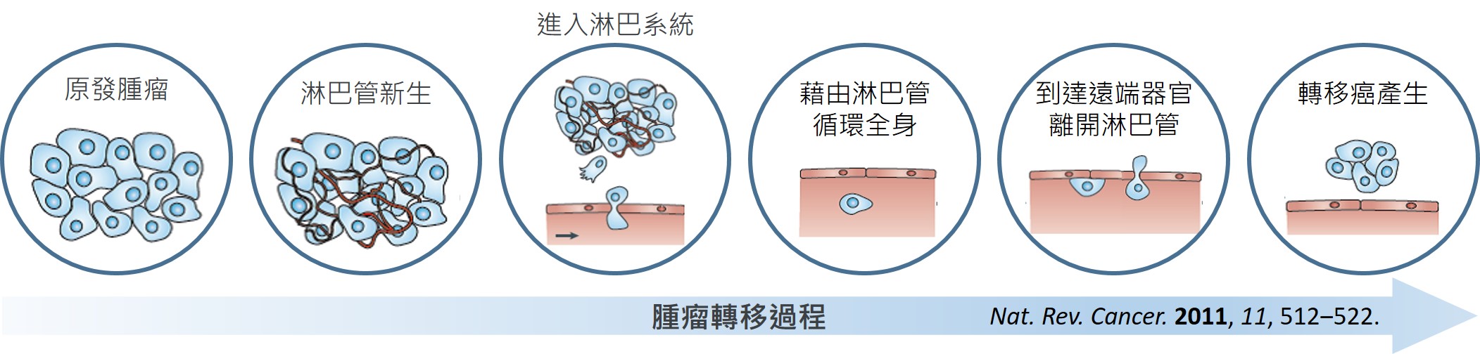 腫瘤轉移過程流程圖